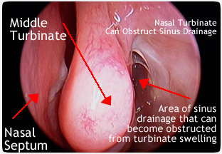 inside a stuffy nose